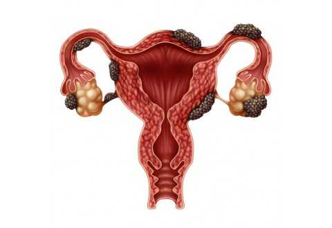 Trastornos menstruales en mujeres jóvenes: detección, tratamiento y papel de la farmacia comunitaria